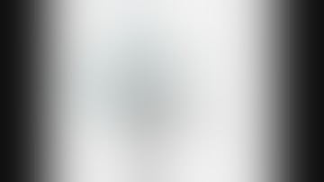 How to use a Robotic Stapler? daVinci SureForm.