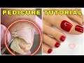 Most Satisfying Pedicure Transformation 😱 best nail polish for toes 2022