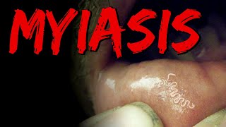 Do you hear a scratching noise before you go to sleep?  |  Body Horror Story