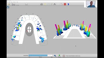 How to Set T-Scan Sensitivity and Record Patient Data