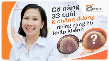 Cô nàng 33 tuổi và chặng đường niềng răng hô, khấp khểnh