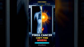 One Scan Finds the Cancer. The Other Finds WHERE It's Hiding. #shorts #medicalphysics #physics