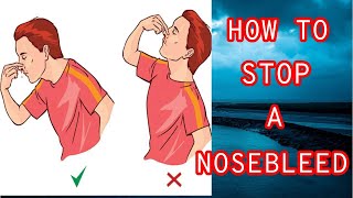 How To Stop A Nosebleed | First Aid For Nose Bleeding At Home