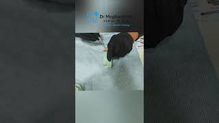 "Flexible Denture Demo – Super Soft, Super Strong | Patient Case Study" screenshot 3