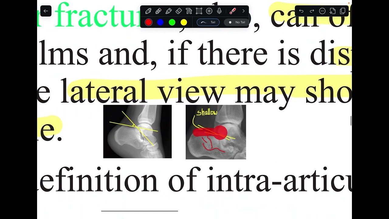 orthopedic- foot injury 
