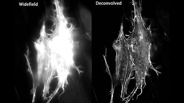 Actin dynamics viewed with deconvolution microscopy