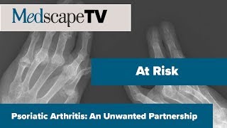 At Risk | Psoriatic Arthritis: An Unwanted Partnership | MedscapeTV