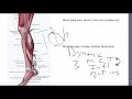 Achilles Tendonitis Is NOT A Tendon Problem