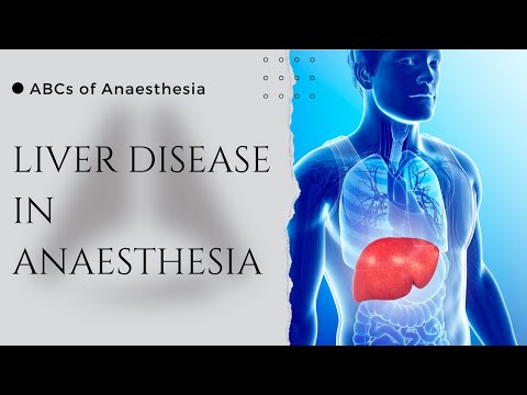 Liver Disease and Anaesthesia
