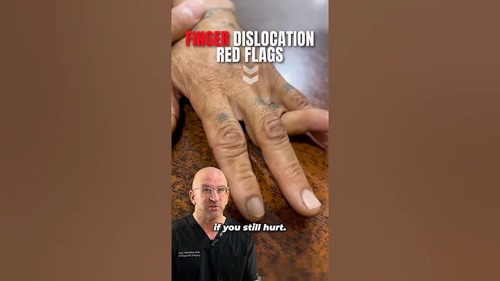 What. NOT To Do With Finger Dislocations⁉️