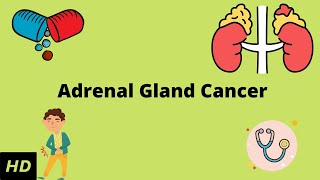 Adrenal Gland Cancer: Causes, Symptoms, Diagnosis and Treatment