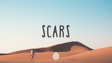 Thumbnail of TobyMac ~ Scars (Lyrics)