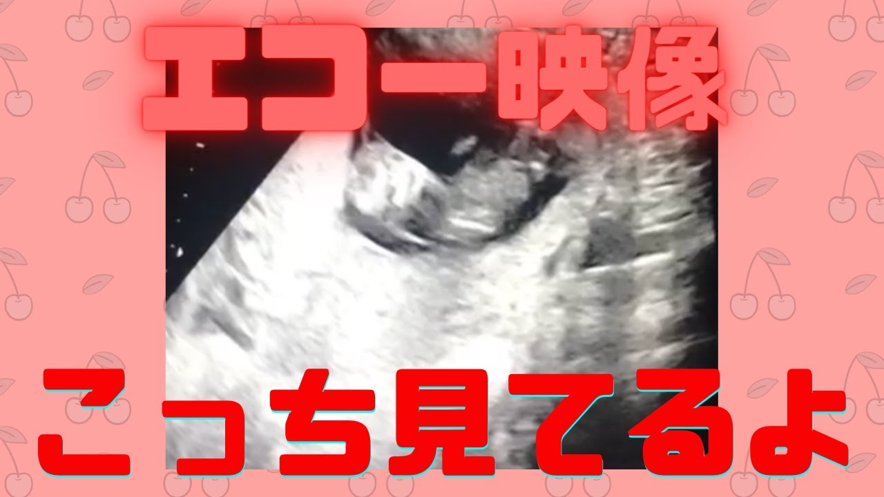 妊娠11週 エコー映像撮ってきました 4dもあるよ よく動く Youtube