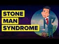 What is stone man syndrome