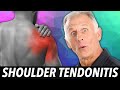 An Effective Self Treatment For Shoulder Tendonitis