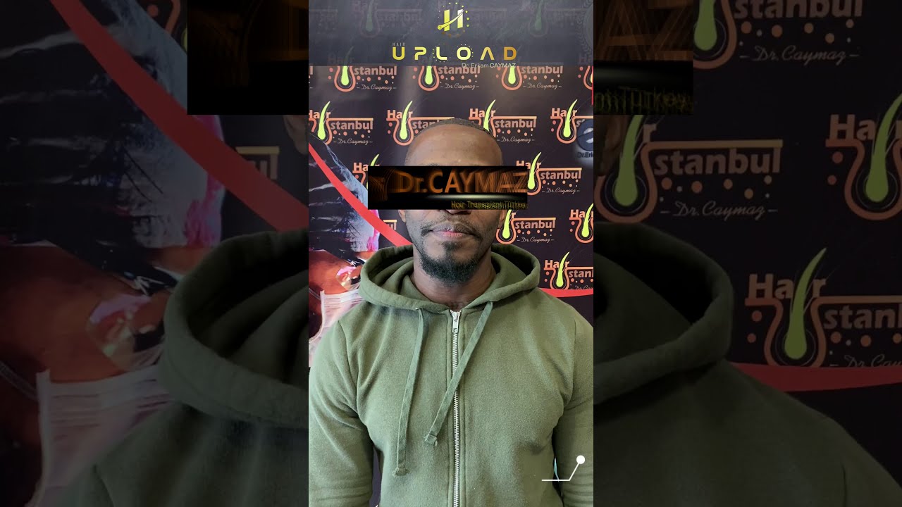 Mr Private - 3000 Graft from USA | Afroamerican Hair Transplant 2021 / Dr.Erkam CAYMAZ