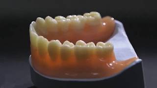 EnvisionTEC Perfactory® VIDA 3D Printer for Dental Application