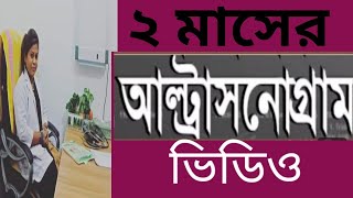 ২মাসের একটি প্রেগনেন্সি আল্ট্রাসনোগ্রাম ভিডিও দেখে নিন