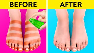 Super Hacks And Gadgets For Your Feet