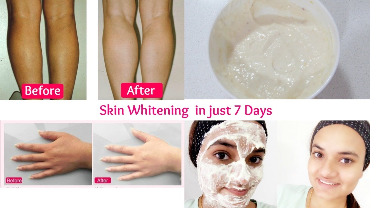 Skin Whitening treatment in just 7 days get smooth glowing radiant