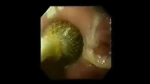 Roth Net fig retrieval video