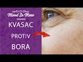 KVASAC PROTIV BORA ZATEŽE KOŽU BRZO I LAKO! | Minut za mene