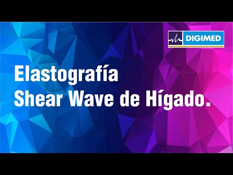 Elastografía Shear Wave de Hígado con el Dr. Álvarez del Rivero