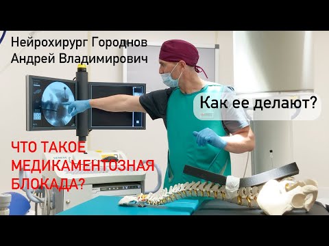 Что такое медикаментозная блокада? Как ее делают?