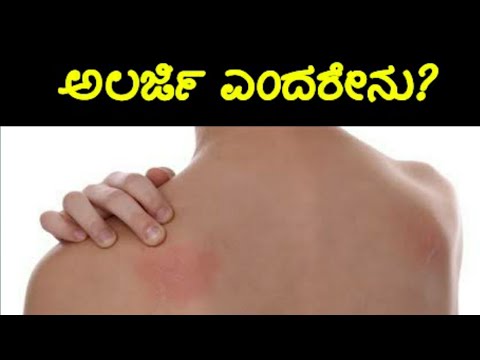 Intresting Facts about Allergy In kannada || ಅಲರ್ಜಿ ಎಂದರೇನು?