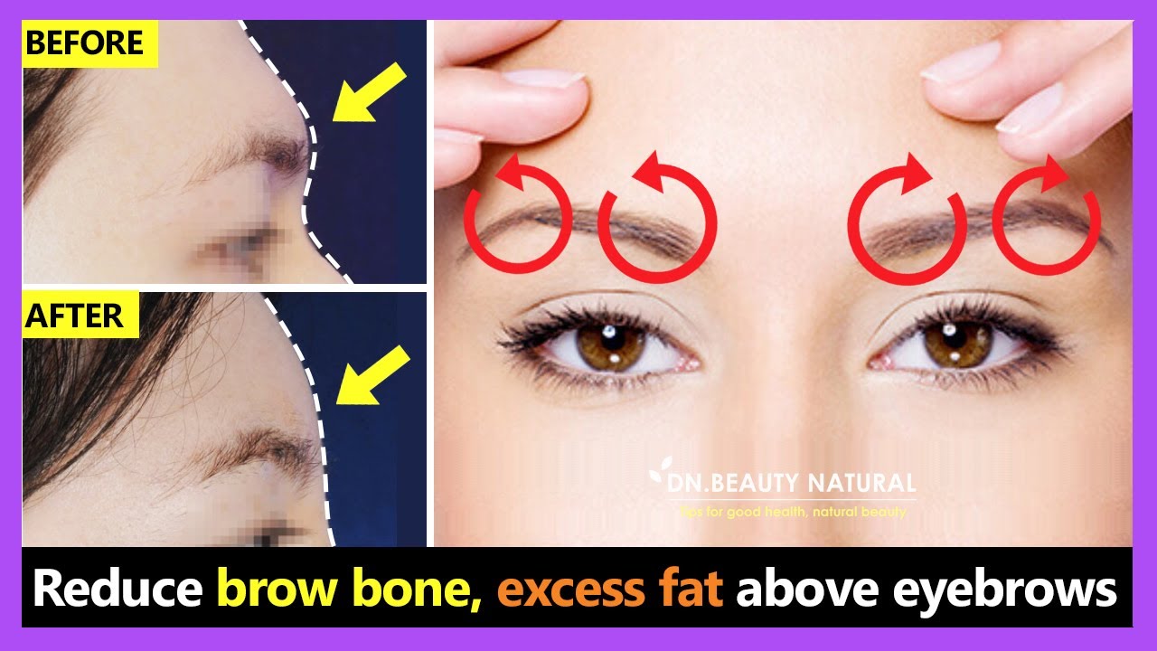 How To Reduce Brow Bone Naturally And Remove Excess Fat Above The Eyebrows With Exercise \U0026 Massage