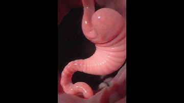 Inside the Stomach & Intestines: Cross-Section View of Digestion | AI Anatomy Visualization 🧪🫀