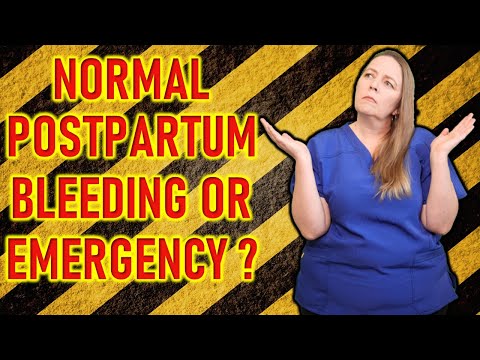 Video: 3 manieren om normale postpartumbloedingen te identificeren