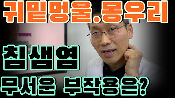 귀밑멍울, 귀밑몽우리! 침샘비대증의 가장 무서운 부작용은?[침샘염증상]  I #루이빈치과 류지헌 원장