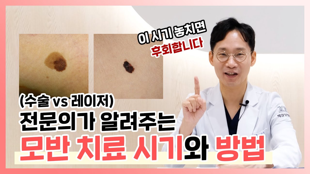전문의가 알려주는 모반치료 시기와 방법 (수술 Vs.레이저) #선천성모반 #모반수술 #모반레이저 - YouTube
