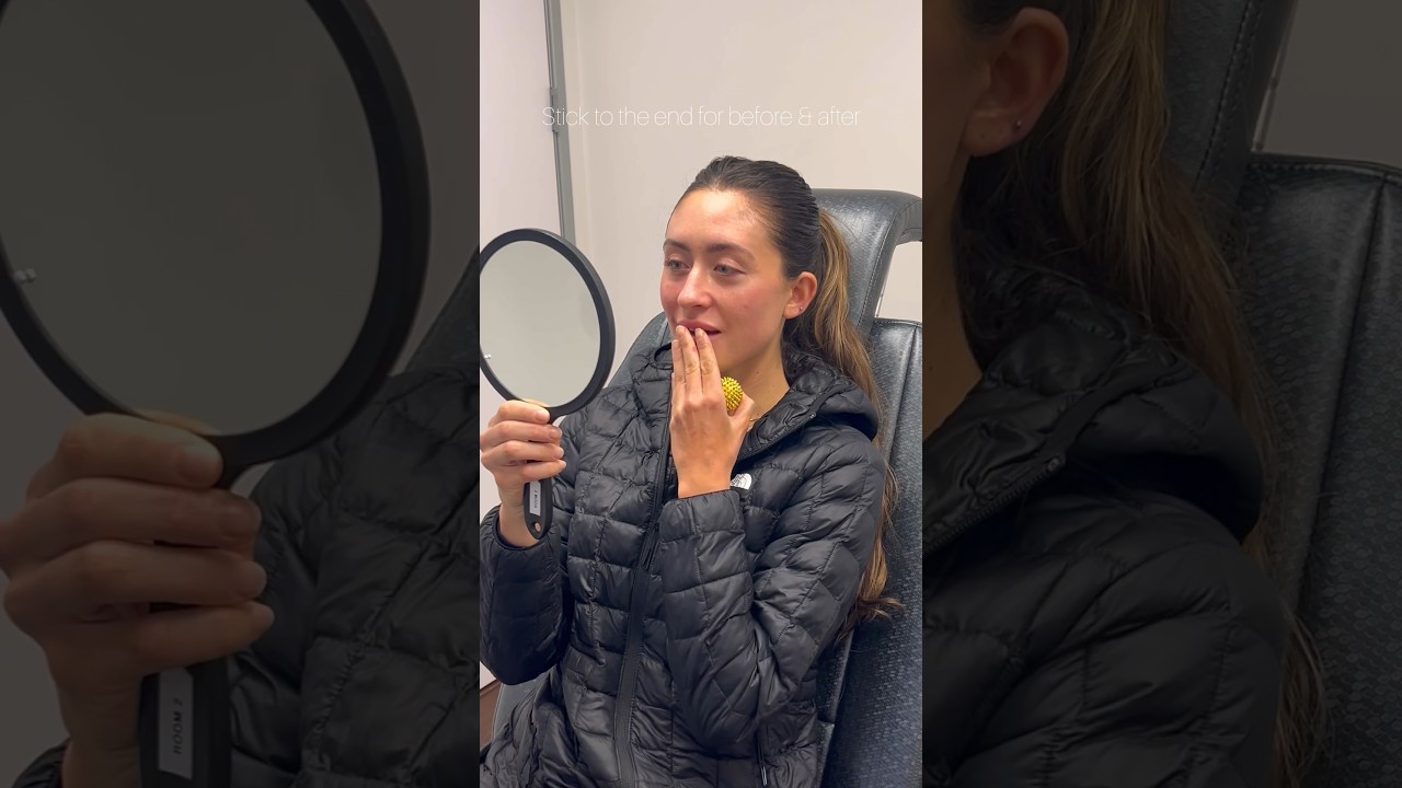 Раскройте секреты филлера для щек 👀 до и после в конце видео 