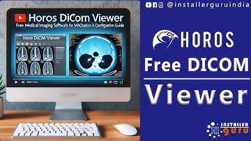 Horos DICOM Viewer: Free Medical Imaging Software for macOS - Installation & Configuration Guide