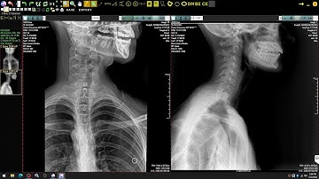 DDR (Dynamic Digital Radiography) Chiropractic X-Ray System from 20/20 Imaging