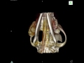 3D CT Scan - Canine Skull Vimago™