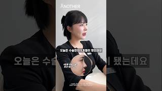 총괄실장의 5번째 #코재수술 5개월차 #브이로그 #코성형브이로그