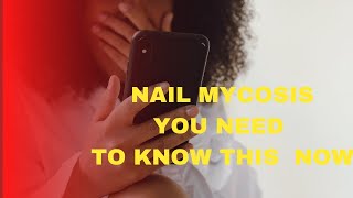 HOW TO TREAT MYCOSIS OF NAILS