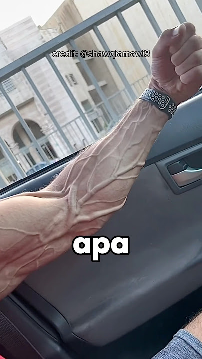 Why Do Some People Have Protruding Hand Veins Like This ⁉️😱
