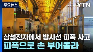 삼성전자에서 방사선 피폭 사고...피폭으로 손 부어올라 / YTN