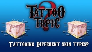 Tattoo Topic - Tattooing Different Skin Types
