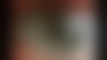 ASCRS 2010   Angle Kappa