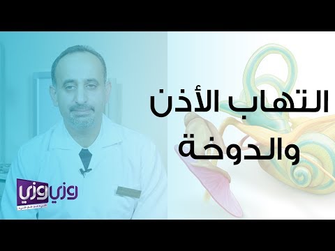 فيديو: هل الصمم يسبب الدوار؟