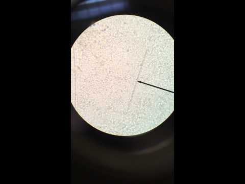 Hanging drop method: Proteus Vulgaris under a microscope