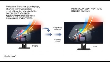 Perfectlum Color & Grayscale Calibration for Diagnostic Accuracy | PerfectLum | QUBYX