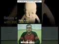 #shorts Why babies have more bones | #Authenticbiofactory