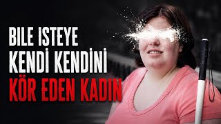 Bi̇le İsteye Kendi̇ Kendi̇ni̇ Kör Eden Kadin: Jewel Shuping