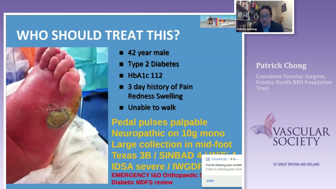 Digital management of the diabetic foot attack